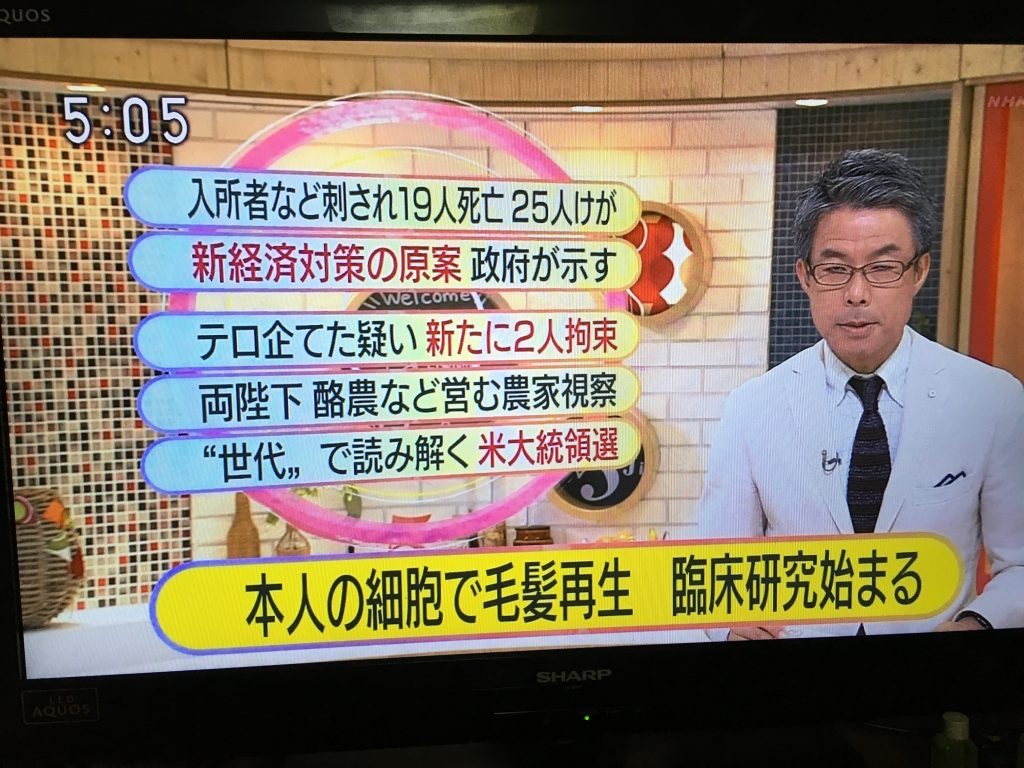 毛髪再生NHK