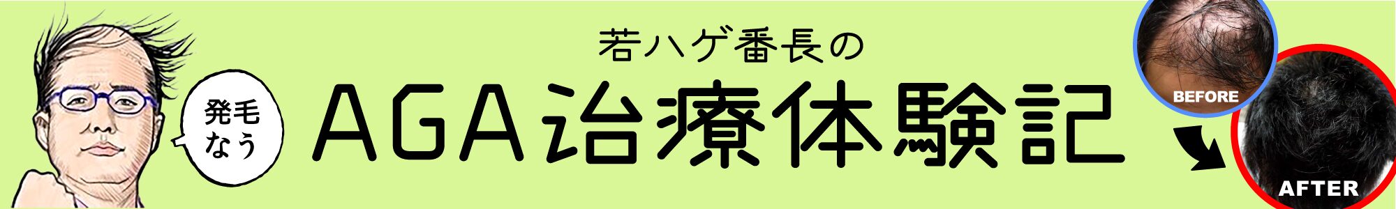 若ハゲ番長の毛髪再生研究室